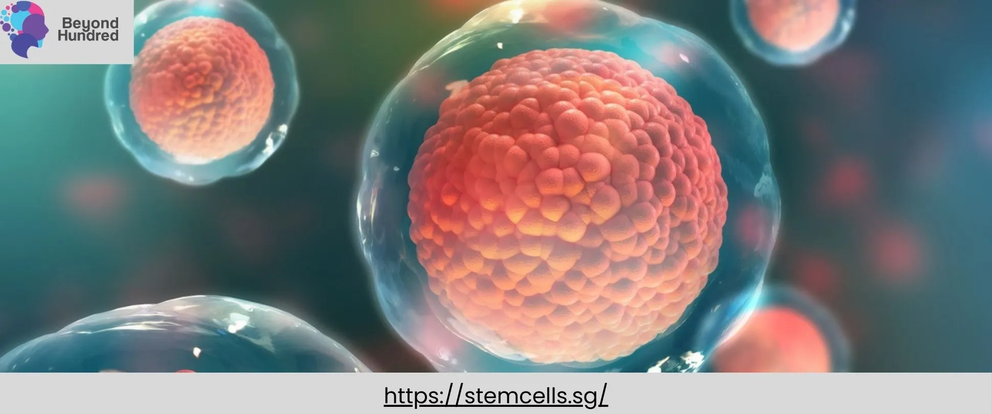 MSC Therapy detail of type 2 diabetes